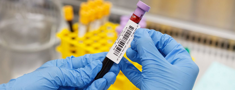 Präzision im Labor beginnt bei der richtigen Kennzeichnung